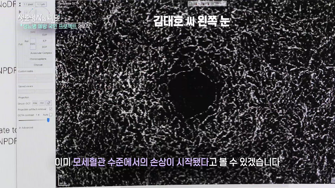 생로병사의 비밀