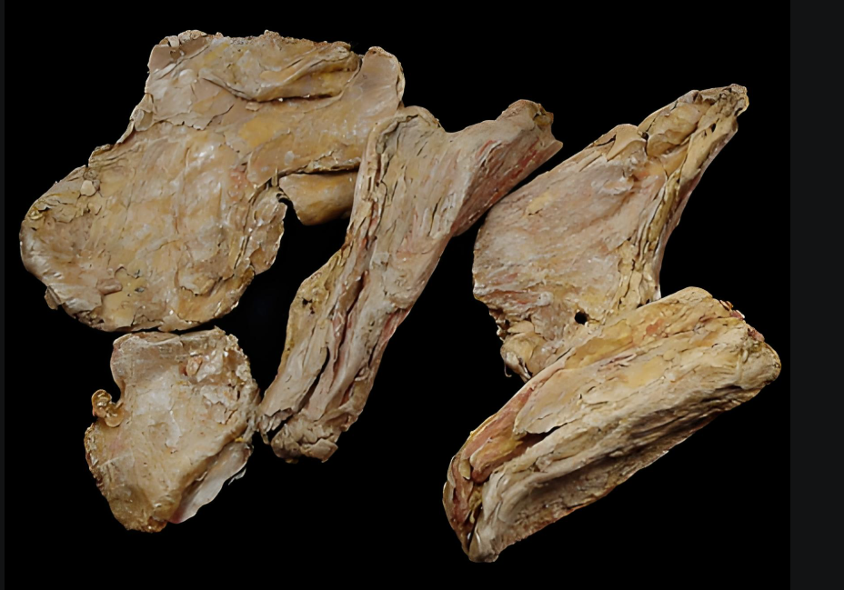 렉토라이트(Rectorite)