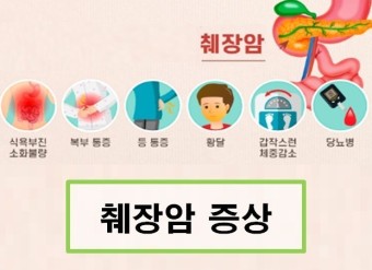 췌장암의 원인과 증상