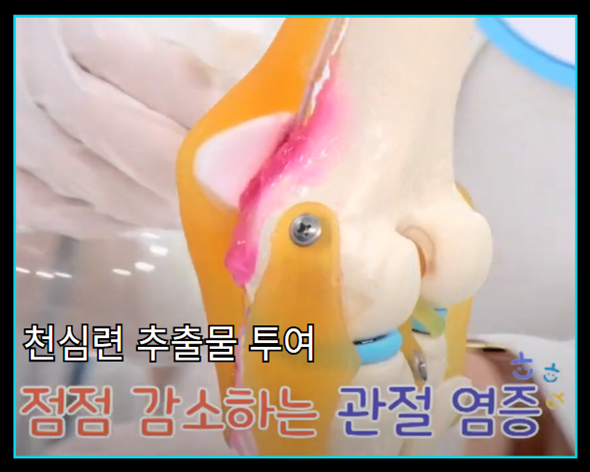 천심련 추출물 파렉틴 - 관절 염증 완화