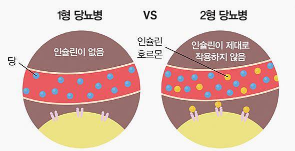 당수치 낮추는 방법