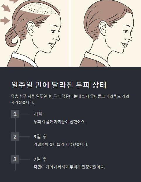 일주이 만에 달라진 두피 상태