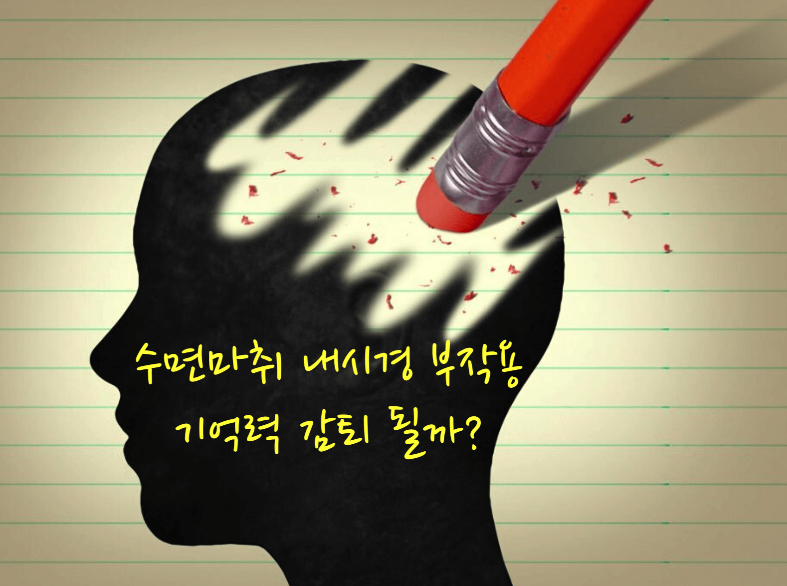 수면마취 기억력