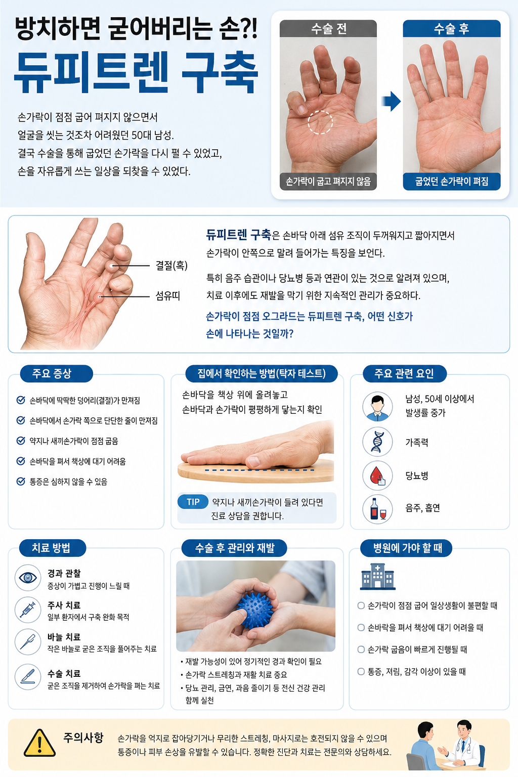 듀피트렌 구축