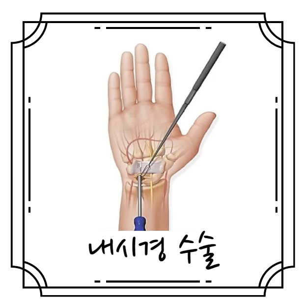 내시경 수술