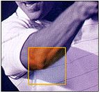 팔꿈치 바깥쪽 통증