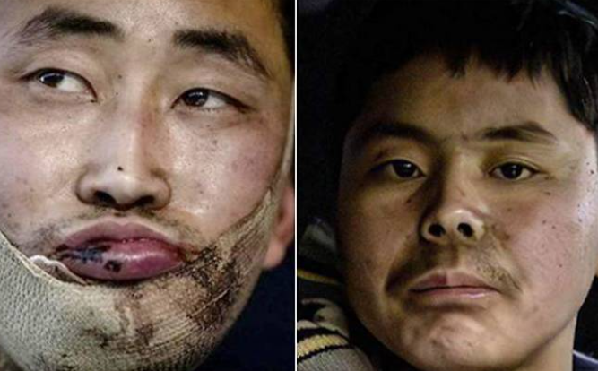 젤렌스키 포로 송환