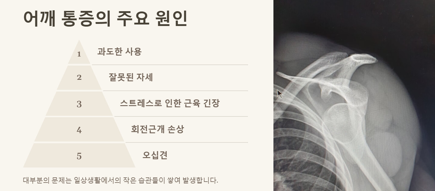 어깨 통증 8초만에 잡는법