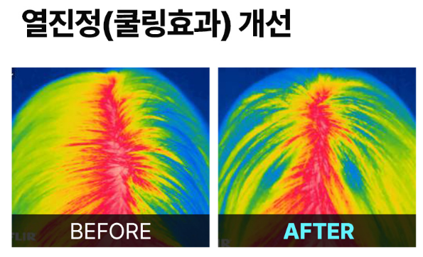  두피와 탈모가 걱정이라면? 