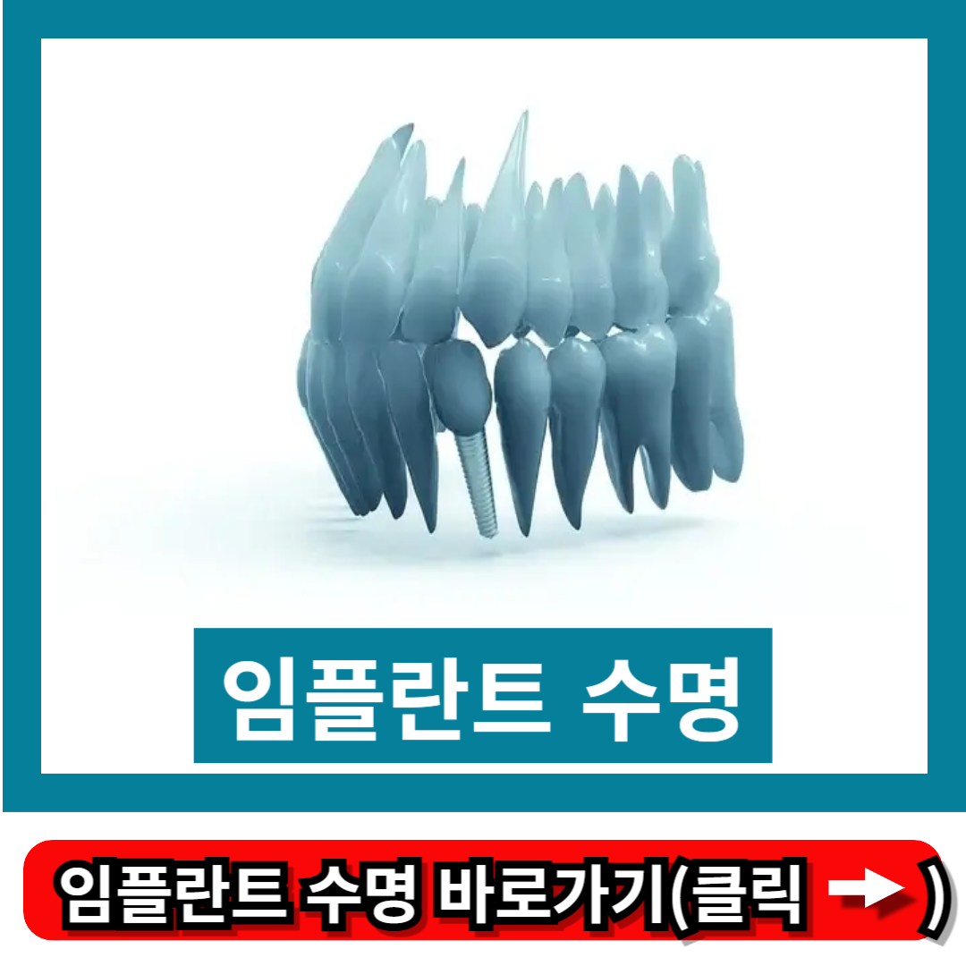 임플란트 수명