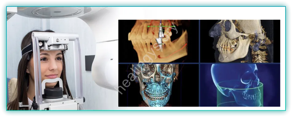 3D CT