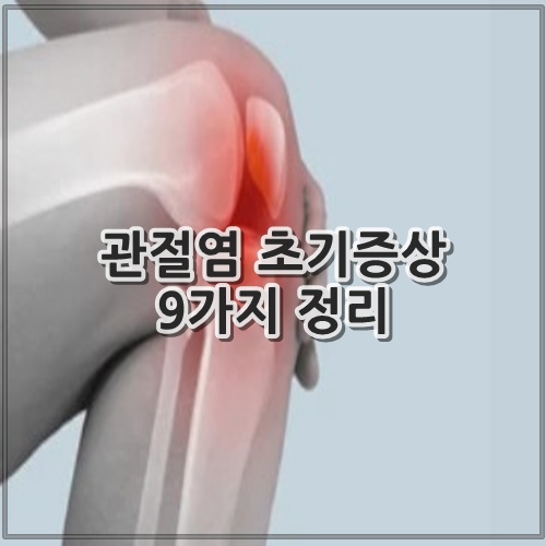 관절염 초기증상 9가지 정리