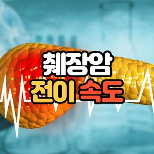 췌장암 전이속도