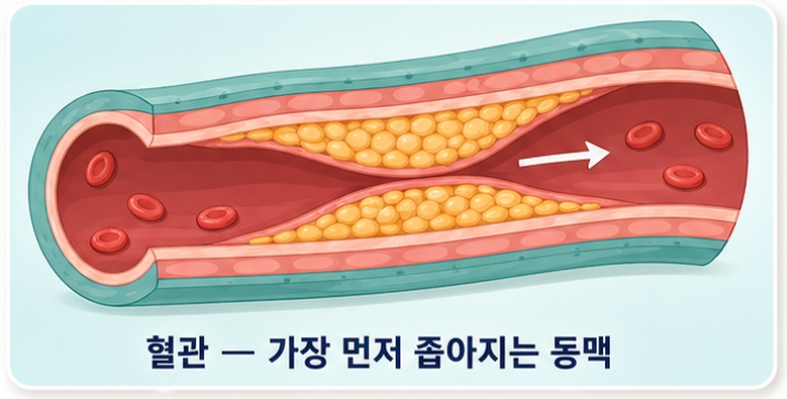 혈관 가장 먼저 무너지는 곳