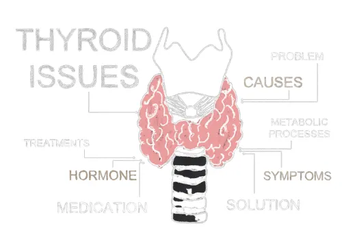갑상선 기능 저하증 원인 증상 치료방법