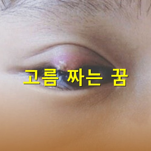 눈에-다래끼가-나서-앞이-잘보이지-않는-모습