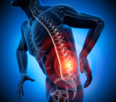 허리 디스크 증상