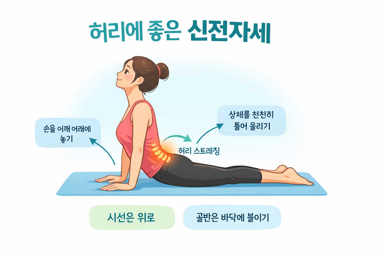 맥켄지 3단계 운동법