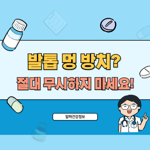 발톱-멍-무시하지마세요