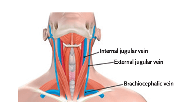경정맥 손상 위험 후유증 이재명대표상황