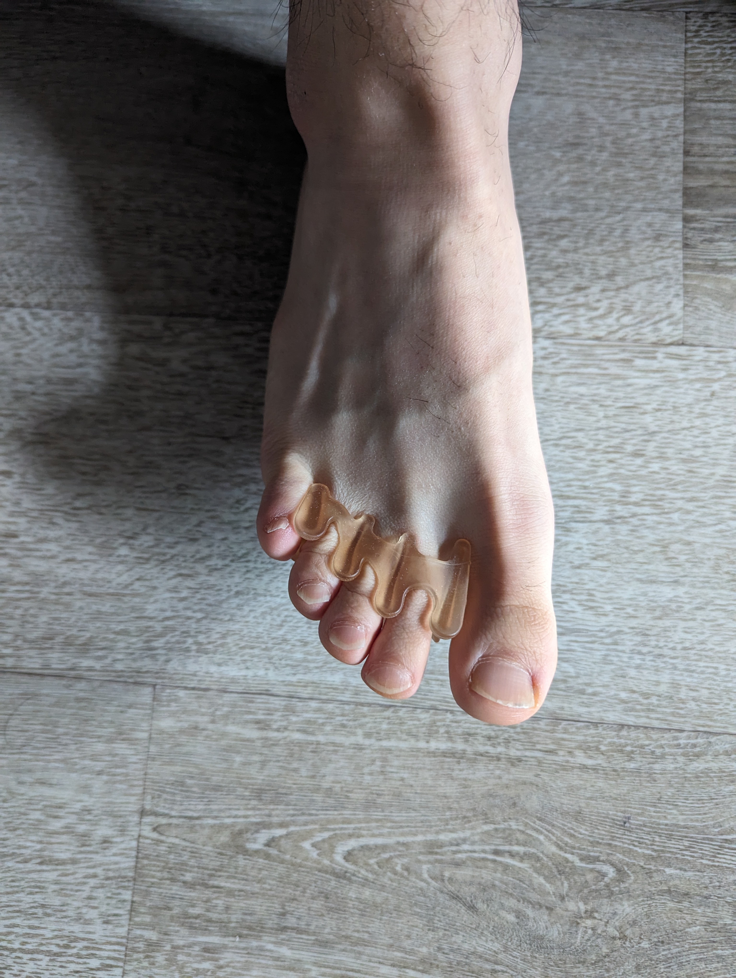 닥터데이즈 무지외반증 교정기 착용