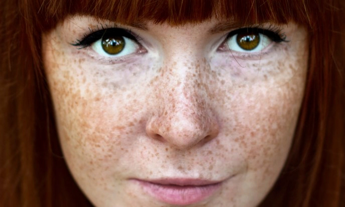 기미 제거에 도움이 되는 음식