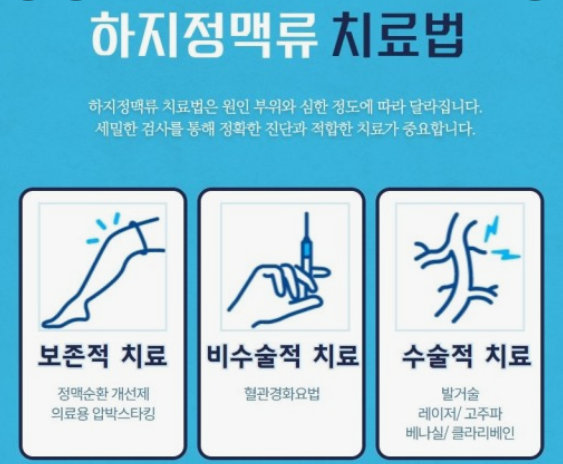하지정맥류 치료법