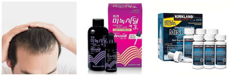 탈모, 미녹시딜 3%, 커클랜드 미녹시딜 사진