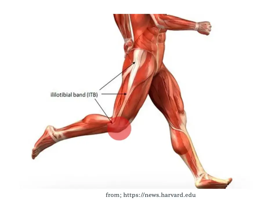 슬개대퇴통증증후군: 원인, 증상 및 효과적인 관리 방법
