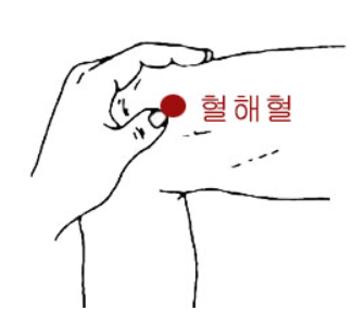 생리통이 심해지는 이유와 관리 방법