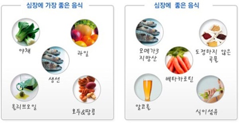 심근경색