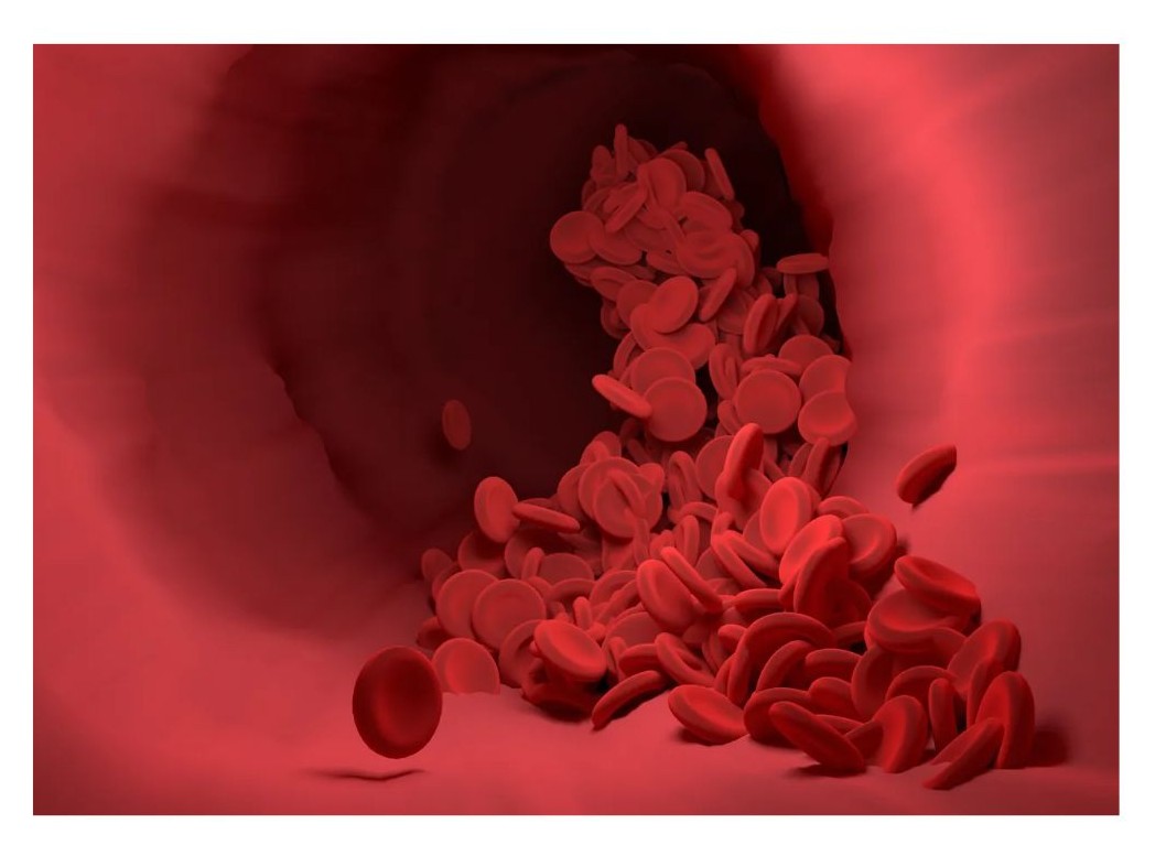 총 콜레스테롤 이란