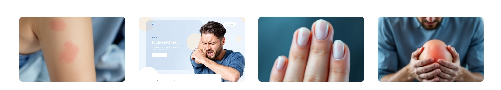 건선 증상 확인하기