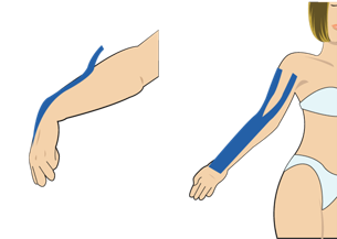 팔꿈치가 잘 펴지지 않을 때
