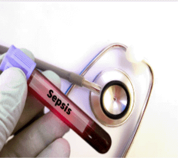 비브리오패혈증