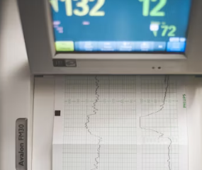 뇌졸중 전조증상 5가지 예방법 원인