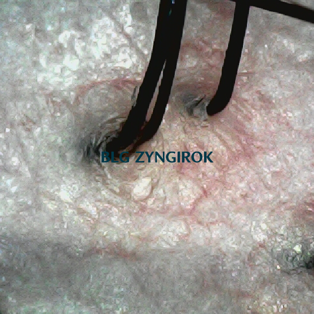 피나모아 복용 20주차 - 뒷머리 두피 모습이다.