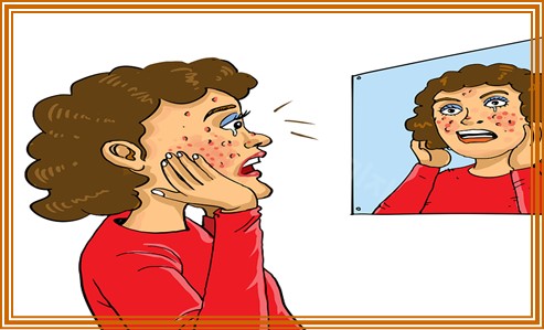 임신중 피부 트러블 이유 6가지