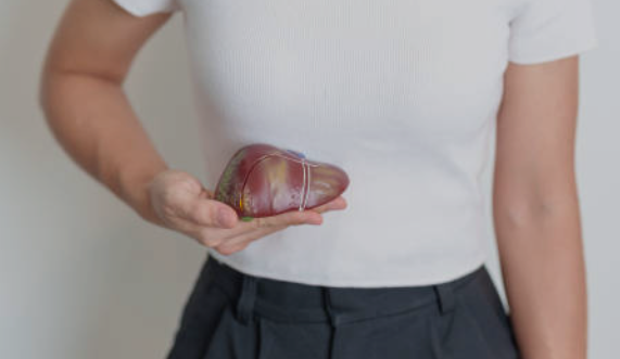 간수치 낮추는법