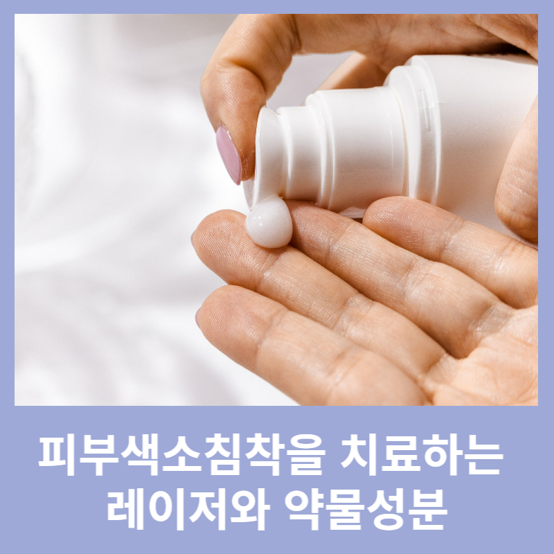 피부색소침착 치료