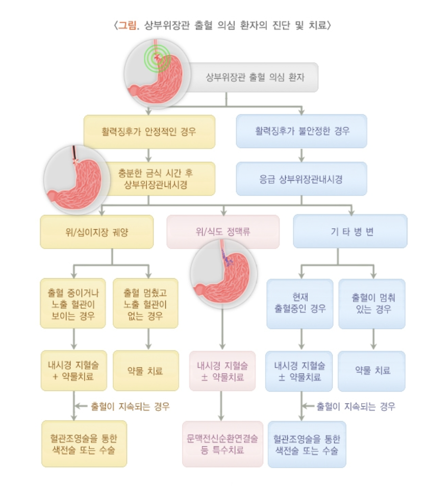 상부위장관 출혈 의심 환자
