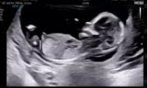 2026 출산·육아 혜택 총정리 👶|첫만남이용권부터 부모급여·아동수당까지 완벽 비교!