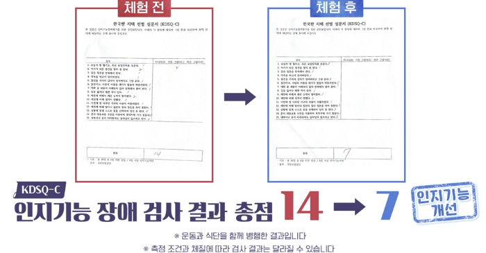 포스파티딜세린 효능