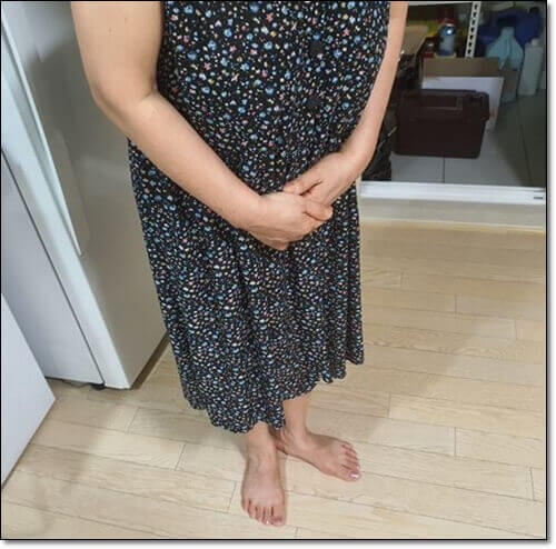 가보시안 낭종이 생긴 여성