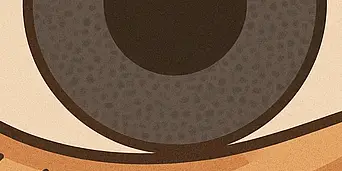 눈이 침침해지는 이유