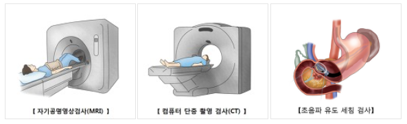 췌장암초기증상