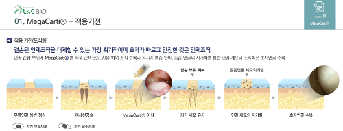 메가가티 적용기전및 국내 퇴행성 관절염 연도별 연령대별 진료현황 