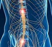 요통 원인과 증상