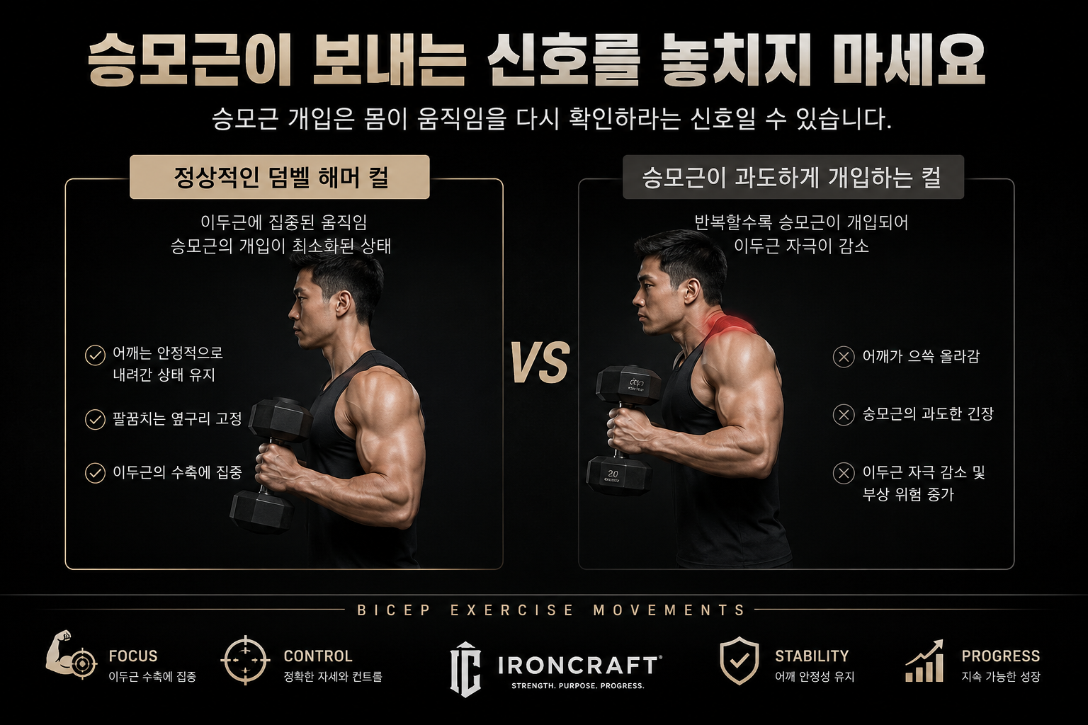 승모근이 보내는 신호를 놓치지 마세요