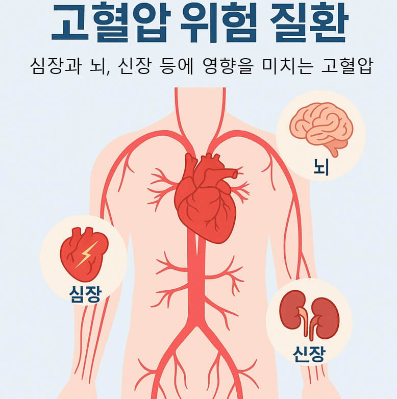 고혈압 위험 질환